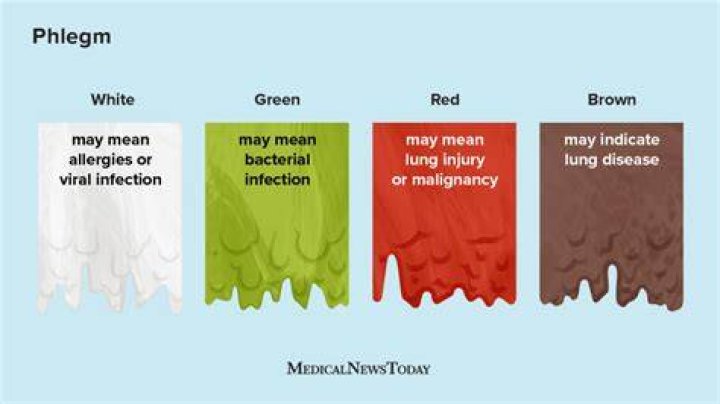 Can heart problems cause phlegm?