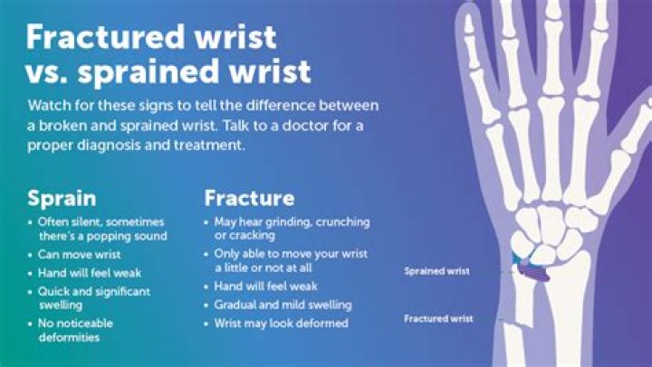 When does a sprain need surgery?